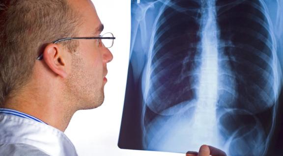 Radioloog kijkt naar röntgenopname van menselijke longen