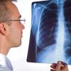 Een radioloog bekijkt een rontgenfoto van longen